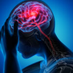 Surprising Causes of Headaches