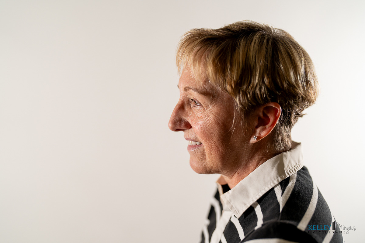 A woman with short blonde hair, wearing a black and white patterned jacket and white blouse, is shown in profile against a plain white background, embodying the confidence often seen through modern cosmetic dentistry.