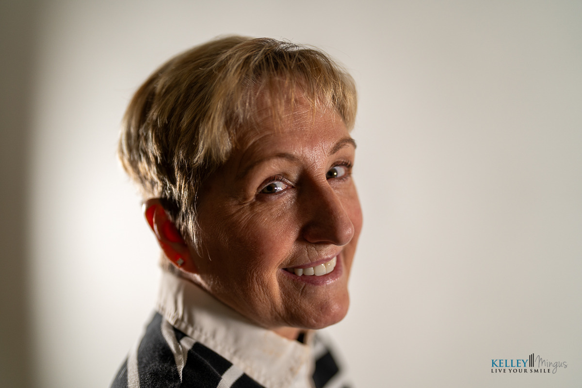 Smiling older woman with short blonde hair looks over her shoulder, wearing a striped shirt, against a plain background—her confident grin is a perfect example of how long do porcelain veneers last when well cared for.