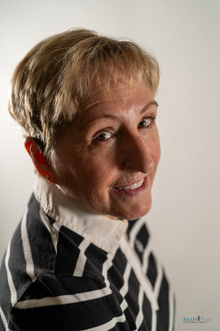 A person with short light hair, wearing a striped jacket over a white collared shirt, smiles confidently while looking over their shoulder against a plain background—showcasing the radiant results of a Bend Oregon cosmetic dentist.