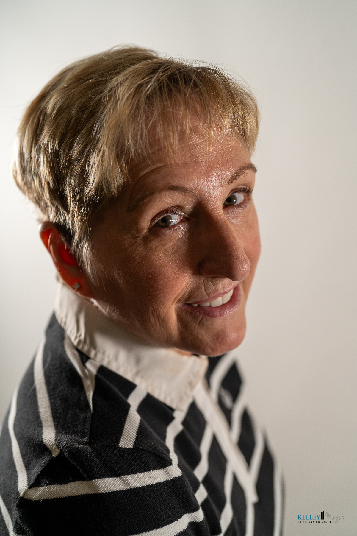 A person with short light hair, wearing a striped jacket over a white collared shirt, smiles confidently while looking over their shoulder against a plain background—showcasing the radiant results of a Bend Oregon cosmetic dentist.