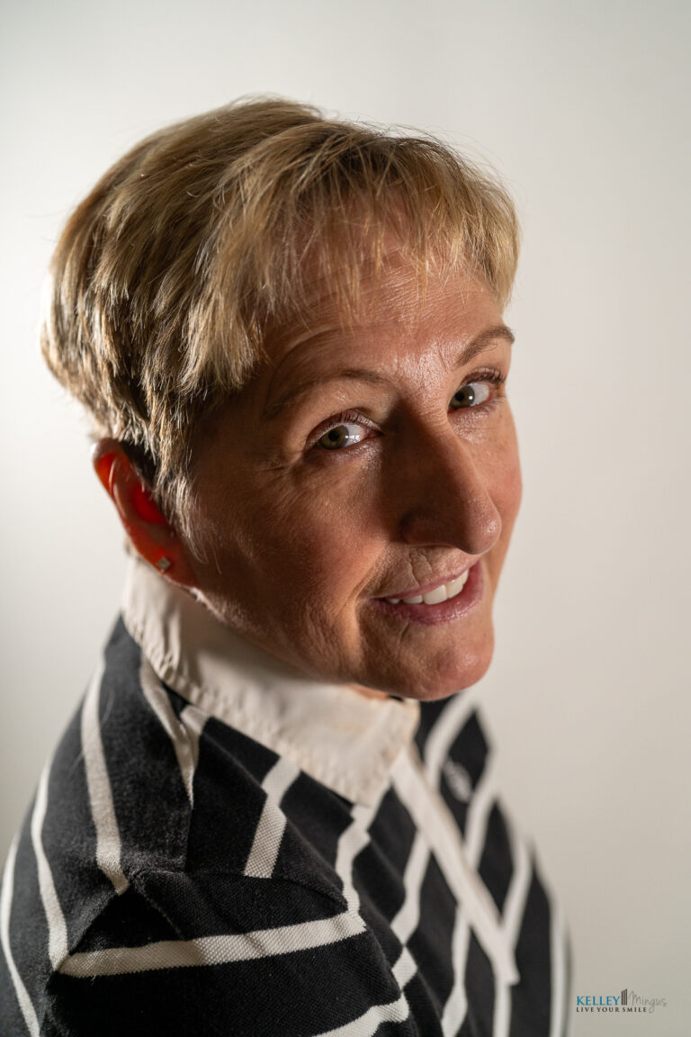 Woman with short blonde hair wearing a black and white striped jacket looks at the camera and smiles slightly against a plain background, radiating confidence as she considers CPAP alternatives for sleep apnea.